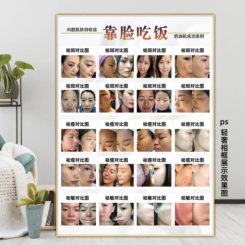 祛斑祛痘海报斑痘敏点痣祛痣图片