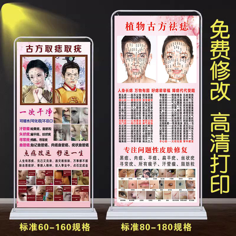 点痣图展架广告画古方风水祛痣祛疣宣传图面部面相挂图男女面痣图