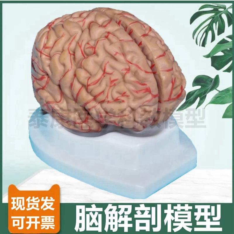 脑模型可拆卸拼装血管神经皮层功能区科普展示卒中破.裂病理神经
