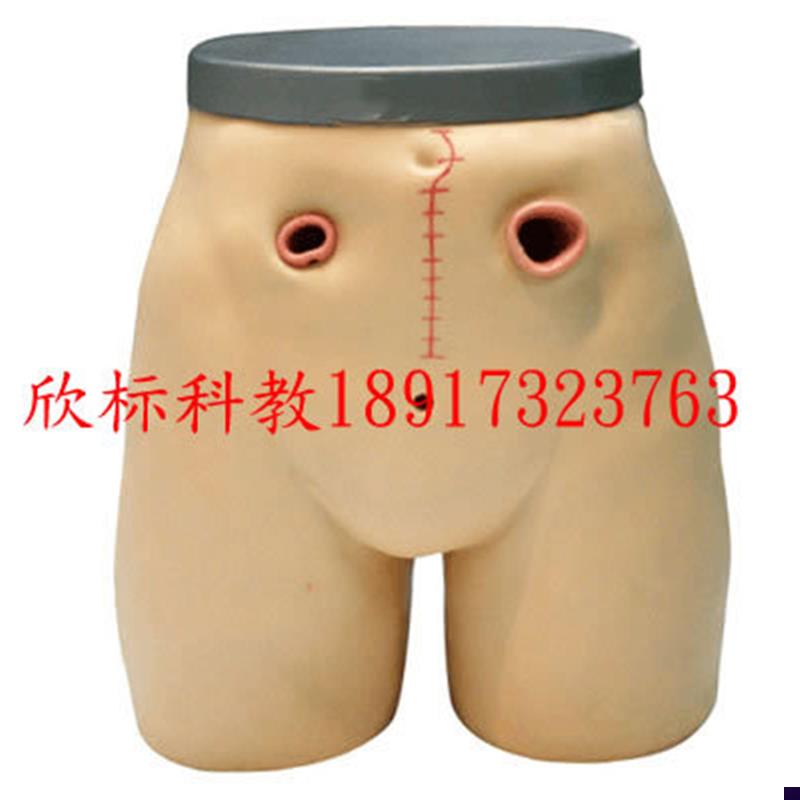高级瘘管造口术护理模型回肠造瘘教学Q模型人体教学培训