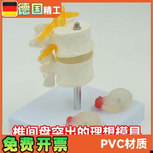 人体腰椎模型椎间盘脊神经根骨骼解剖K医药礼品教学展示用道具