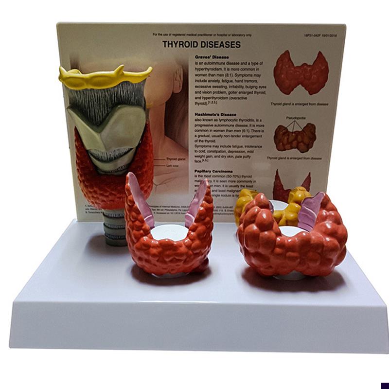 甲状腺解剖模型甲状腺结节甲状腺肿桥I本甲状腺炎乳突癌教学人体