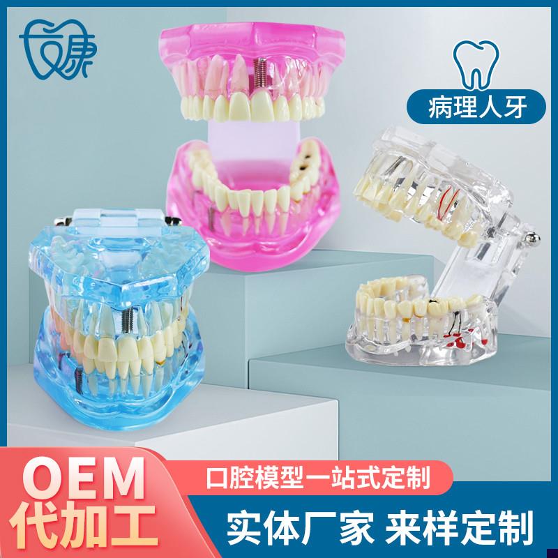 牙齿模型透明精品正常牙适合牙B科医生演示或者学生上课练习用