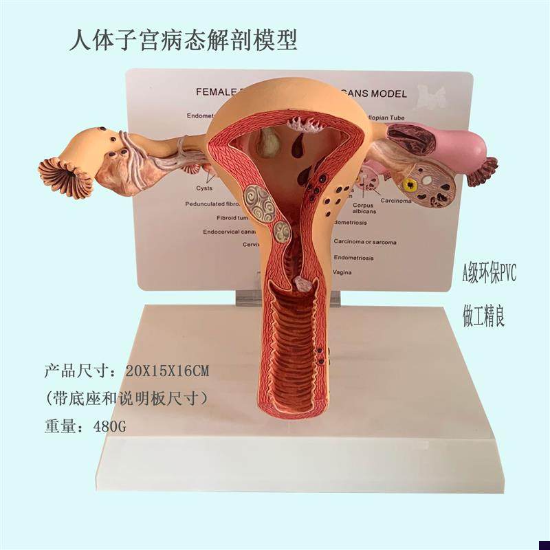 人体女性生殖器子宫模型阴道卵巢妇E科病态子宫产科厂家直销包邮