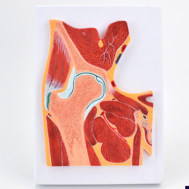 ENOVO颐诺医学解剖髋关节骨骼肌肉模型髋关M节剖面构造MRI骨科关