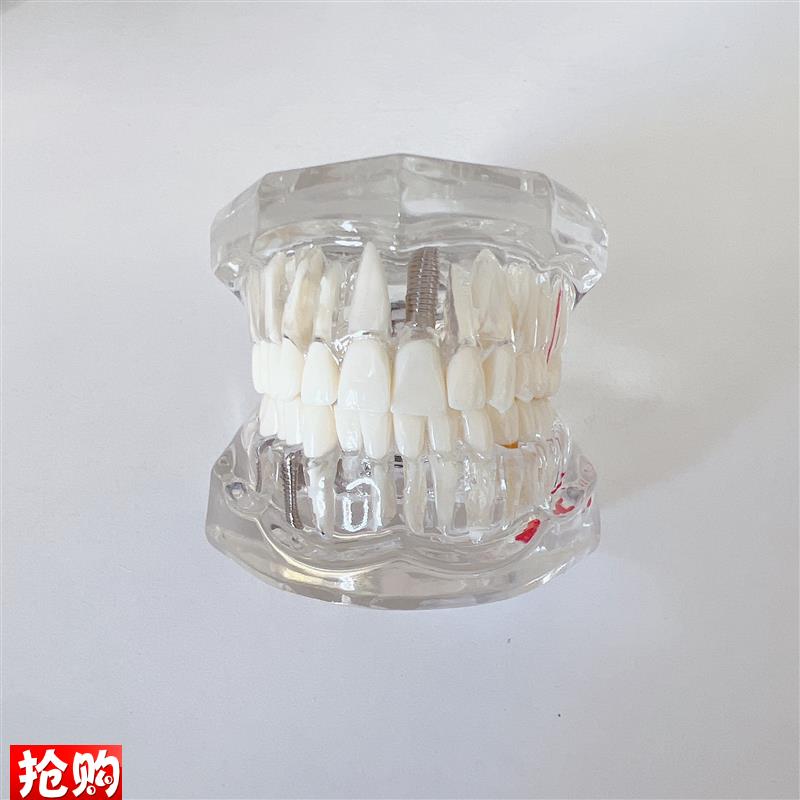 牙齿模型教学模型口腔材料假牙z模型口腔模型病理修复模型工厂直