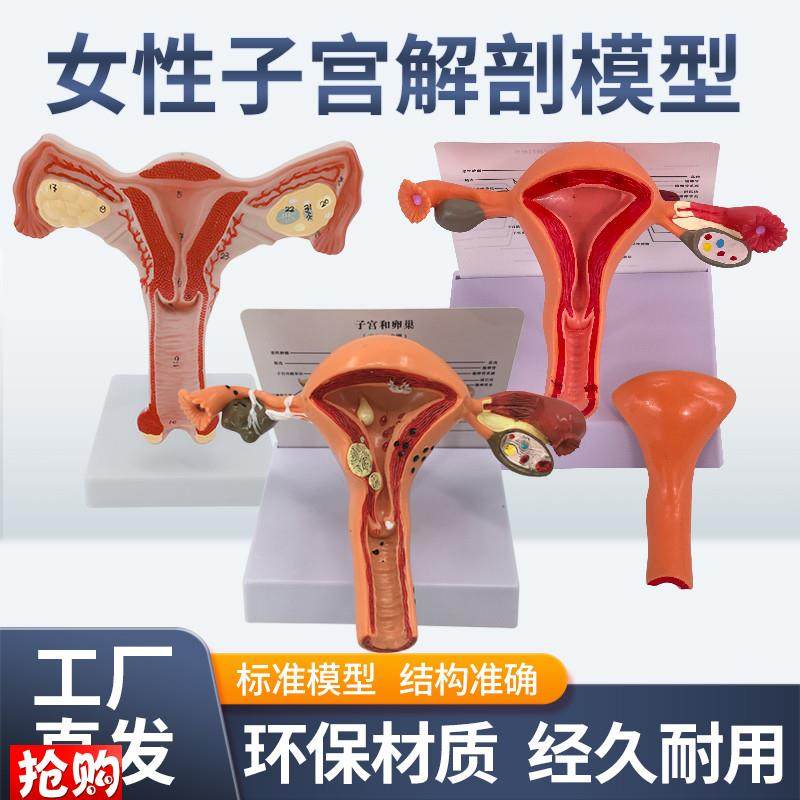 人体模型女性生殖子宫模型阴道卵巢模型教学模具病理变Z化科普教