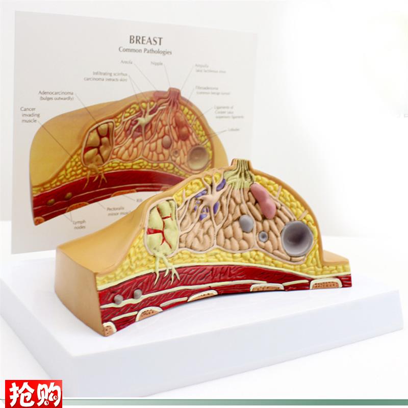 ENOVO颐诺i女性乳房常见病解剖模型乳房乳腺癌肿瘤结节模型母乳哺