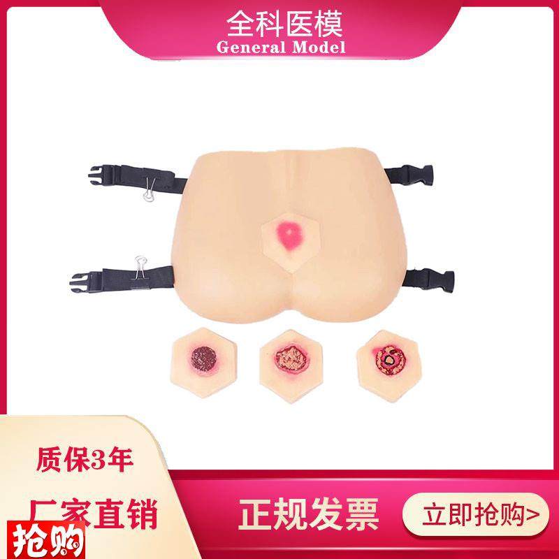 阶段褥疮护理e模型压疮培训教具臀部模型医学教学用模型GM-RC-3