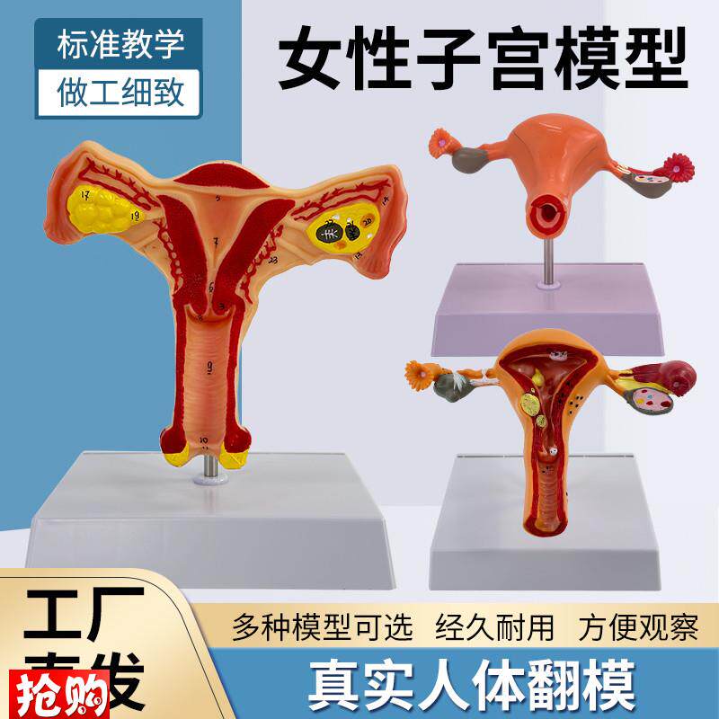 教学子宫卵巢病理变化解剖模型女性内生殖解剖模型妇.科培训教具