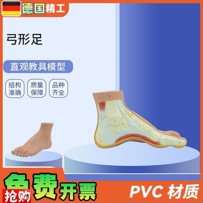 德国】PNT-0727弓形足模型足部病理模型人体S足部解剖模型脚关