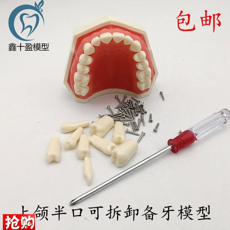 牙科可拆卸牙齿模型上颌半口备牙模型L下颌半口备牙模型包邮