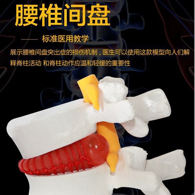 人体脊柱模型脊椎骨头腰椎间盘模具椎体模型突出受压病Z理骨质教