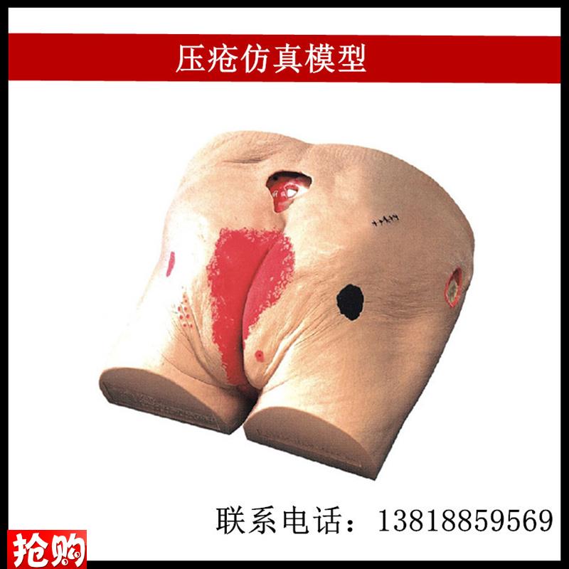 压疮仿真模型