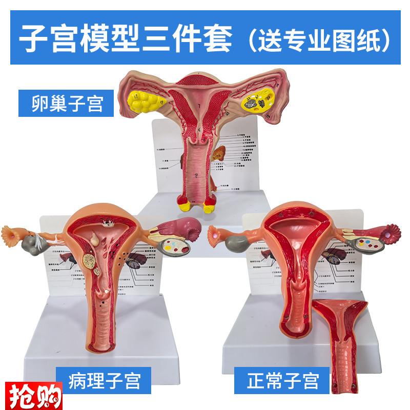 病理子宫模型病变子宫解剖卵巢B模型妇科教具医学人体女性生殖器
