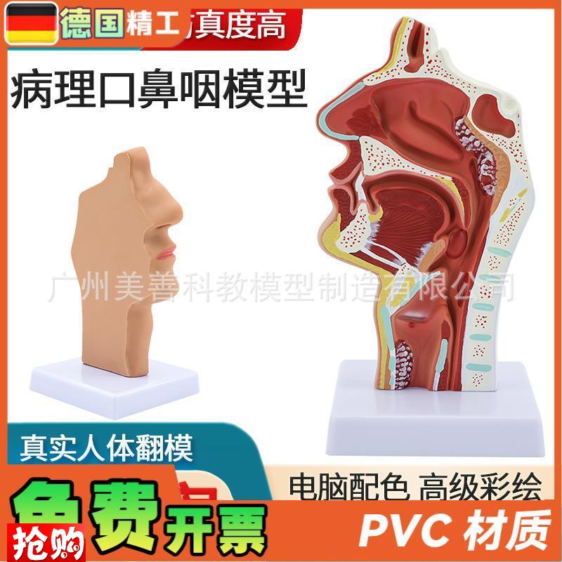 病理鼻腔解剖模型耳鼻喉科教学模型鼻腔鼻U子口鼻结构模型