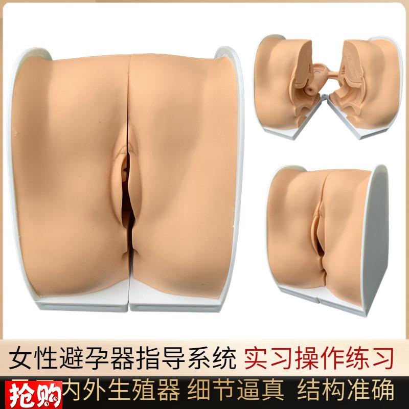避孕指导模型女性避孕模型妇科检E查模型教学培训计划生育专用