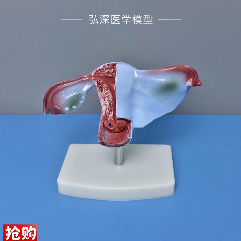 女性子宫模型人体生n殖系统器官解剖卵巢输卵管妇产科医学教学模