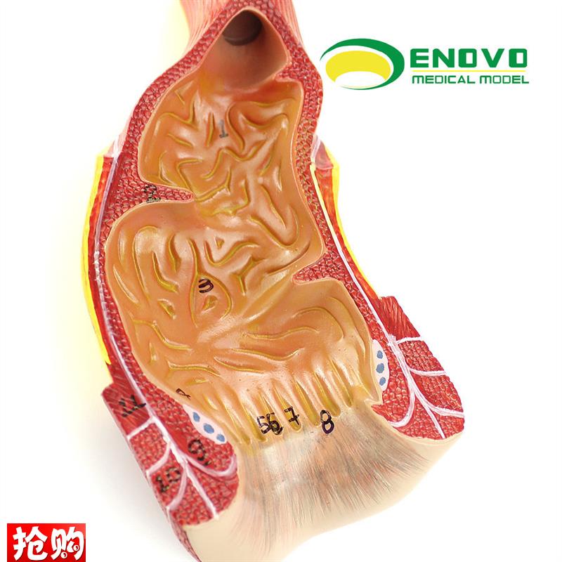 ENOVO颐诺医学人体直肠肛管z肛门解剖结构模型肛肠科外科普外科