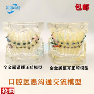 牙科模型正畸结扎丝托槽口腔教学模型H牙齿错颌矫正展示透明牙模