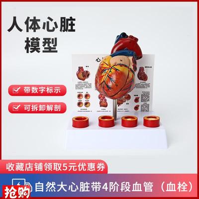 人体心脏模型f四阶段血栓可拆卸冠状动脉心血管血液循环解剖器官