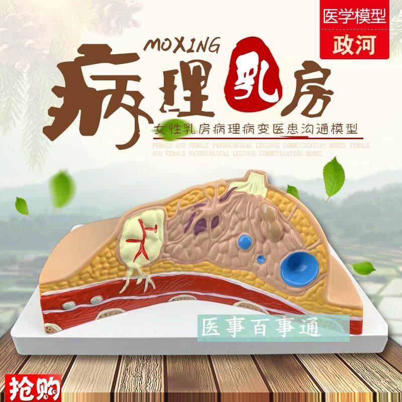 乳房模型解剖催乳培训健康教y育生理生物生殖哺乳期妇女用具器材