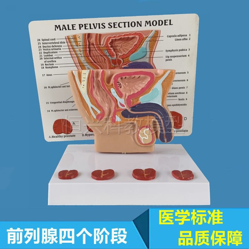 前列腺模型增生肿大病理s男科医患沟通盆腔肛肠泌尿生殖系统膀胱