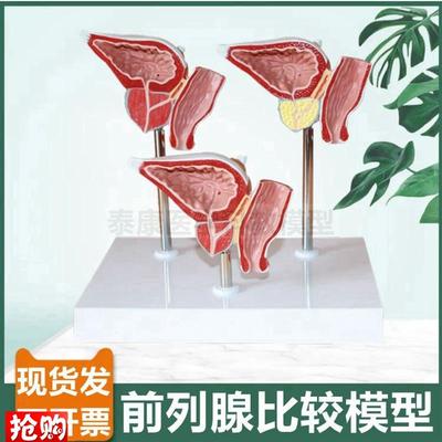 前列腺模型男科生殖泌尿器官膀胱肾脏解剖内外生S殖器睾丸内分泌