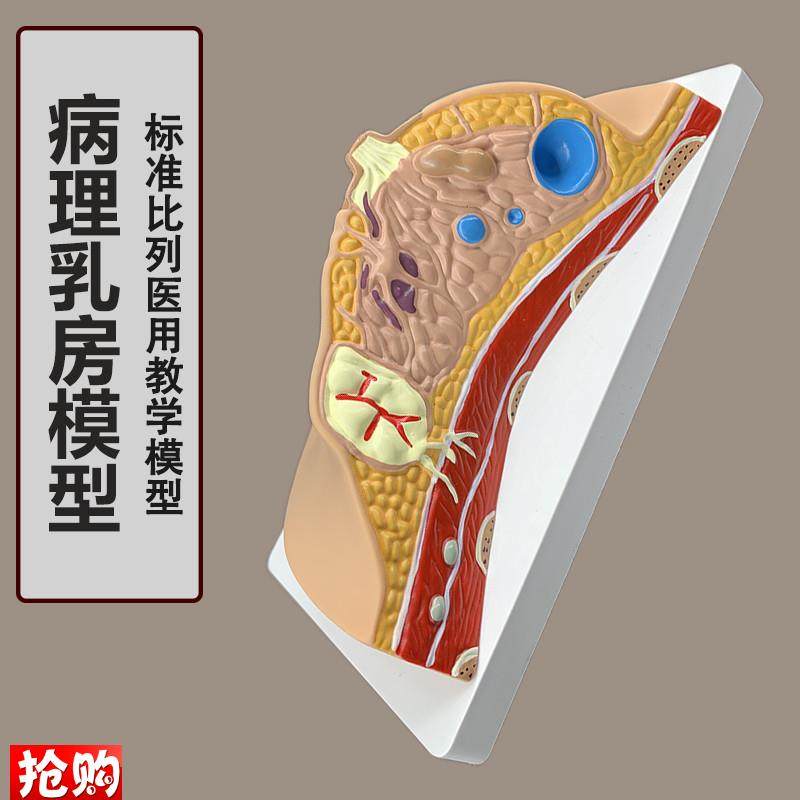 女性病理乳房模型人体1:1乳房模型乳腺解剖S女性医院教学教具