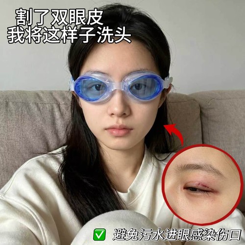割双眼皮术后遮挡防水高清泳镜