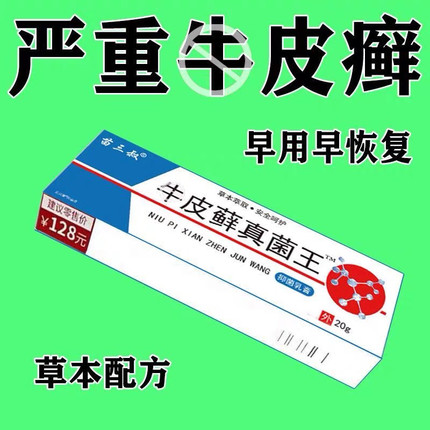 股藓大腿内侧根皮肤瘙痒真菌感染牛皮癣银屑药体股癣去湿疹止痒膏