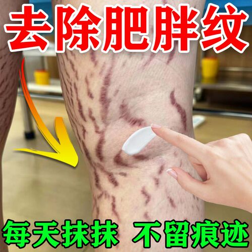 去肥胖纹修复霜生长纹大腿妊辰纹消除去妊娠纹紧致肚皮预防淡化纹