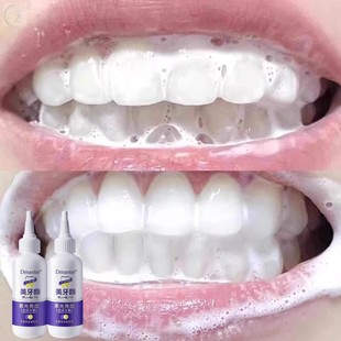 洗牙神器~牙渍一擦即除~黑色烟渍~茶渍~去牙菌斑咖啡渍牙齿变白液