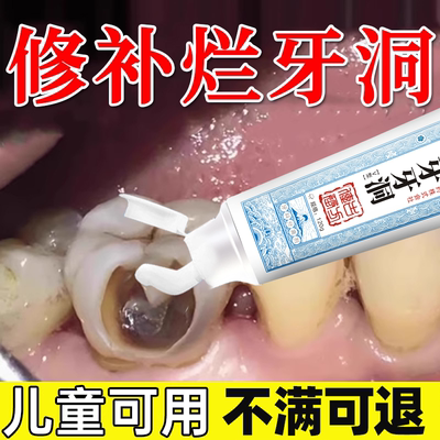 蛀牙龋齿修复虫牙牙菌斑黑线去除牙洞清理牙虫的牙膏KT