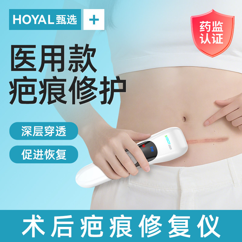 超声波治疗辅助疤痕淡化增生凸起去除疙瘩剖腹产术后修复祛疤仪器