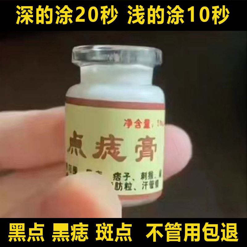 点痣膏无痕正品脸部点痦子取痣去黑痣专用点痣药水神器仪去除黑点