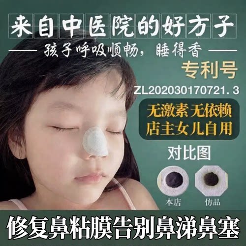 儿童鼻炎贴过敏性鼻炎鼻窦炎鼻塞
