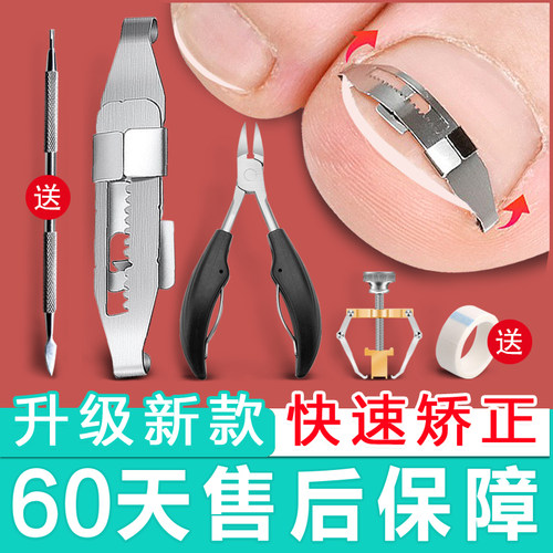 梵庄公实用新型专利嵌甲矫正器扣