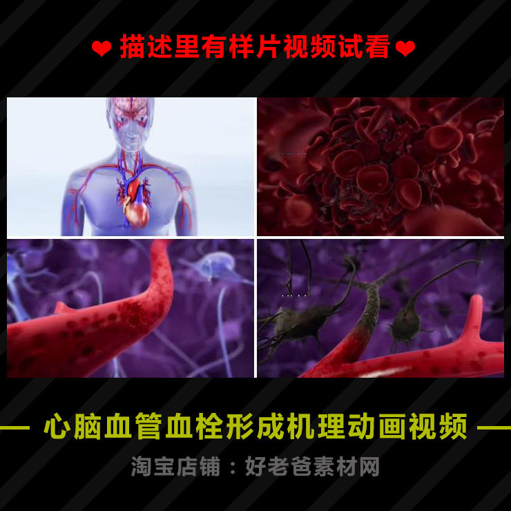 心脑血管血栓形成机理动画MP4视频背景素材VJ