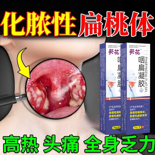 葵花正品咽喉炎慢性咽炎除贴喉咙异物感扁桃体疼痛发炎喷剂凝胶gw