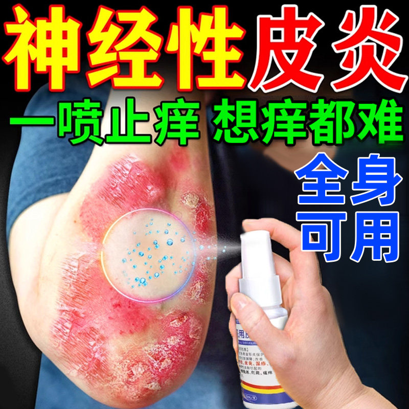 哲也医生神经性皮炎去湿疹真菌感染止痒喷雾皮肤病癣藓液体敷料