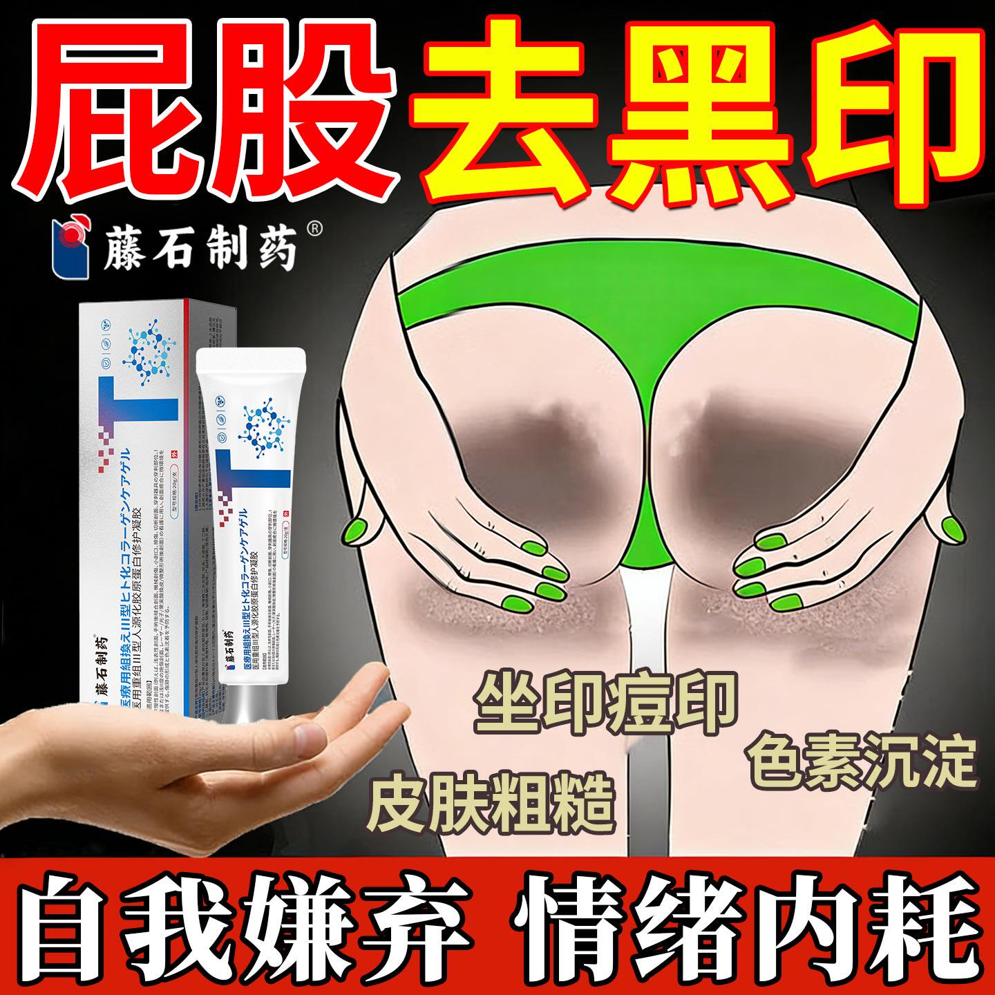 去屁股黑痘印黑坐印黑色素沉淀去屁股坐板疮祛久坐臀部后背黑除SK