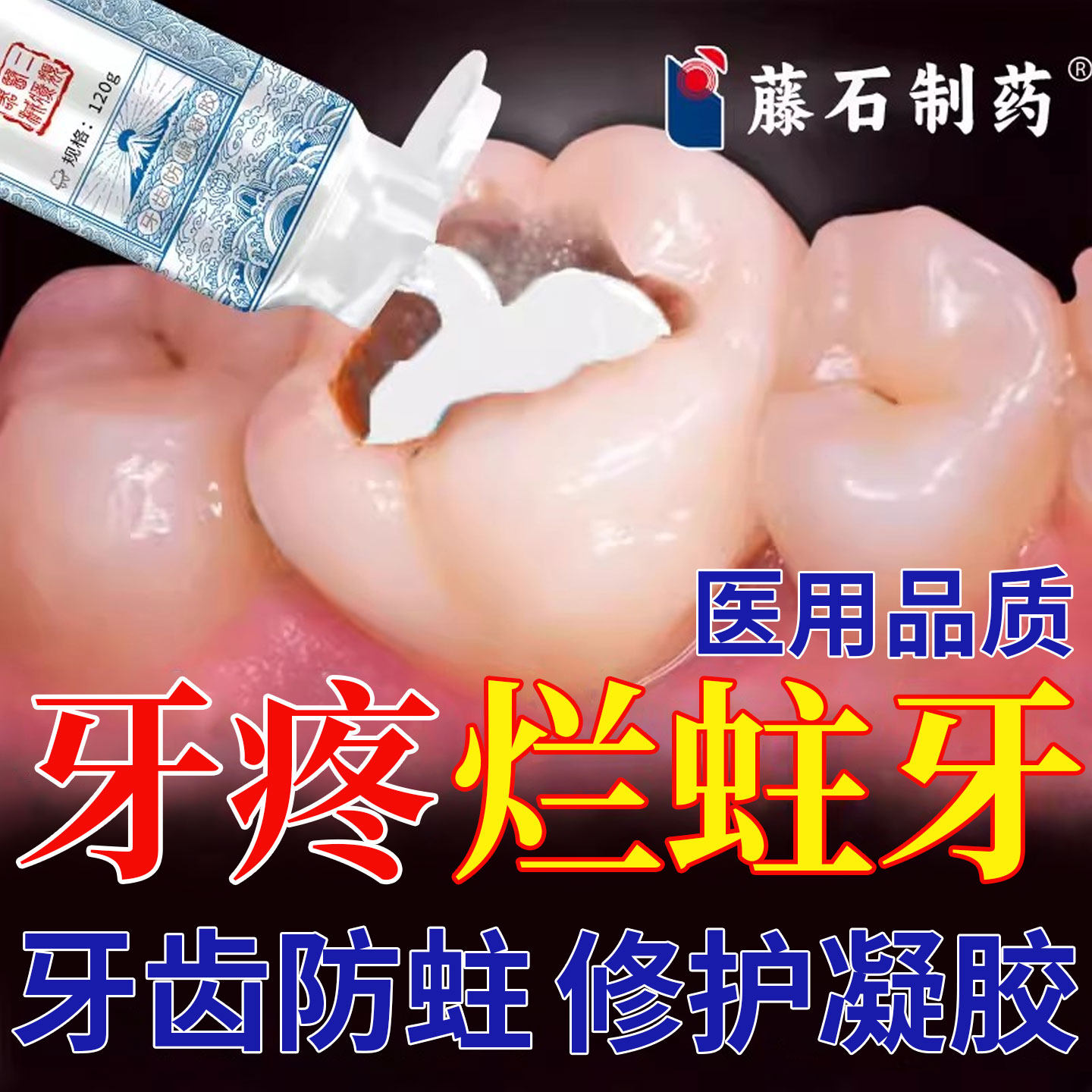 再生硅牙齿防龋凝胶防蛀抗敏含氟成人蛀牙专用牙洞清理牙虫烂牙SK