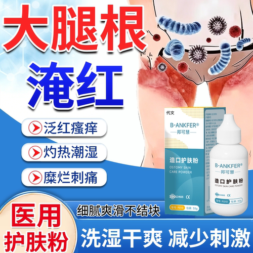 大腿根淹红护肤爽身粉烧裆药监备案股癣真菌感染淹裆内侧防磨擦PG