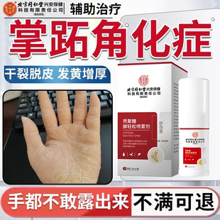掌跖角化症掌趾手掌心脓包疱发黄增厚硬皮角化型湿疹膏脱皮干裂PG