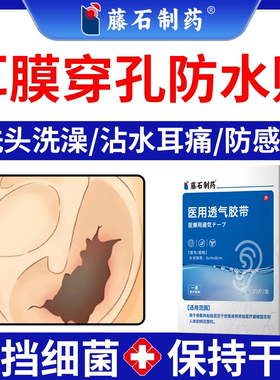 中耳炎耳膜穿孔洗澡防水贴保护耳朵套修复神专用药房同售器大人YI