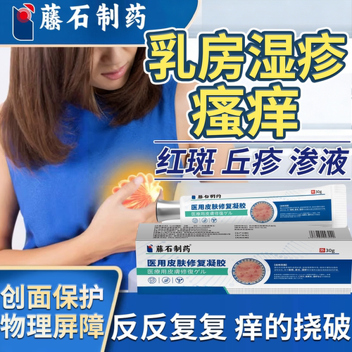 乳房湿疹红斑瘙痒止痒膏