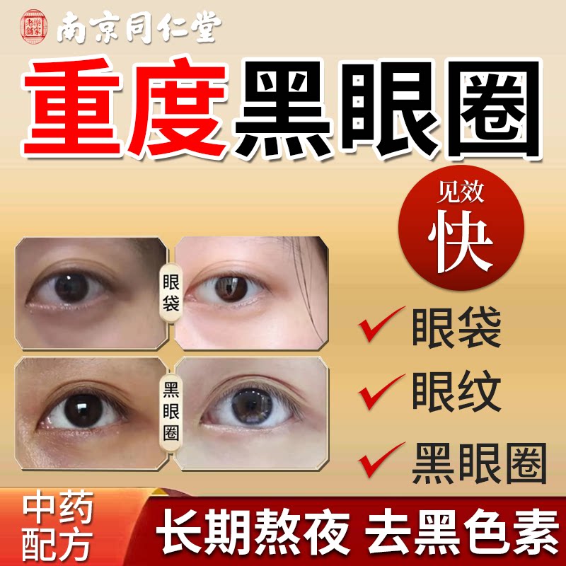 色素型黑眼圈药膏贴去黑色素沉淀去除神器特别严重淡化细纹抗衰ca