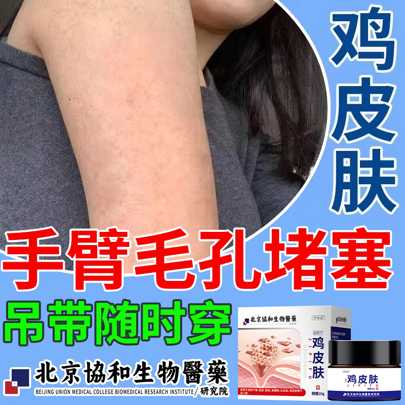 胳膊上小疙瘩手臂上毛孔堵塞疏通鸡皮肤毛囊炎磨砂膏毛周角化症qk