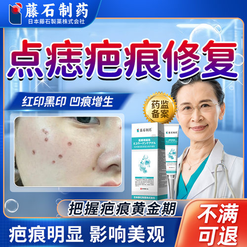 点痣后修复膏去疤痕除疤膏点斑凹陷性去红印生长因子凝胶消印VX